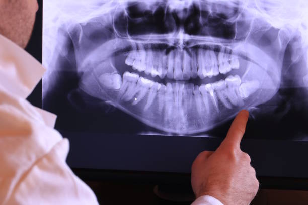 Best Orthodontic Emergency Dentist in Auburn, GA
