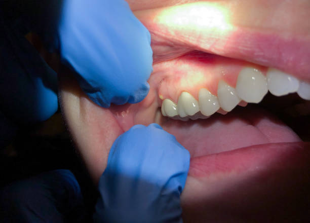 Best Pediatric Emergency Dentist in Auburn, GA