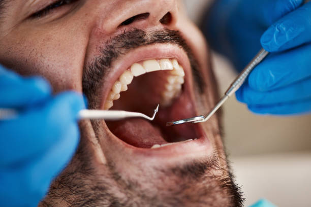 Best Emergency Cosmetic Dentistry in Auburn, GA