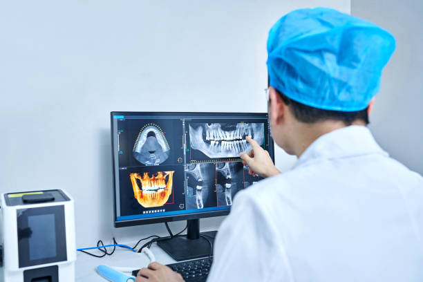 Best Emergency Dentist for Lost Fillings or Crowns in Auburn, GA