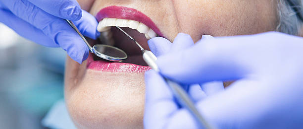 Best Emergency Dental Extractions in Auburn, GA